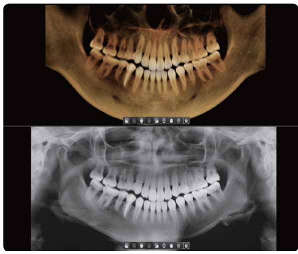 عکس cbct