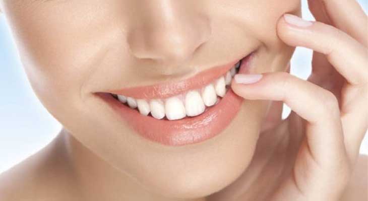 ترمیم لمینت دندان