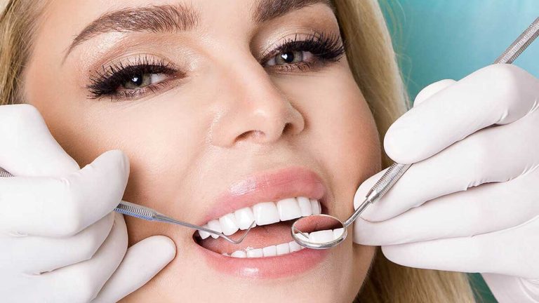 اشتباهات رایج بعد از لمینت دندان